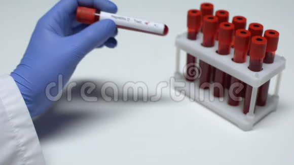 D型肝炎检测阴性医生在试管中显示血样实验室研究视频的预览图