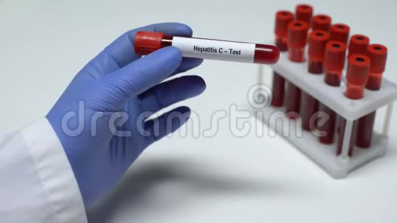 丙型肝炎在试管中显示血样的医生实验室研究健康检查视频的预览图