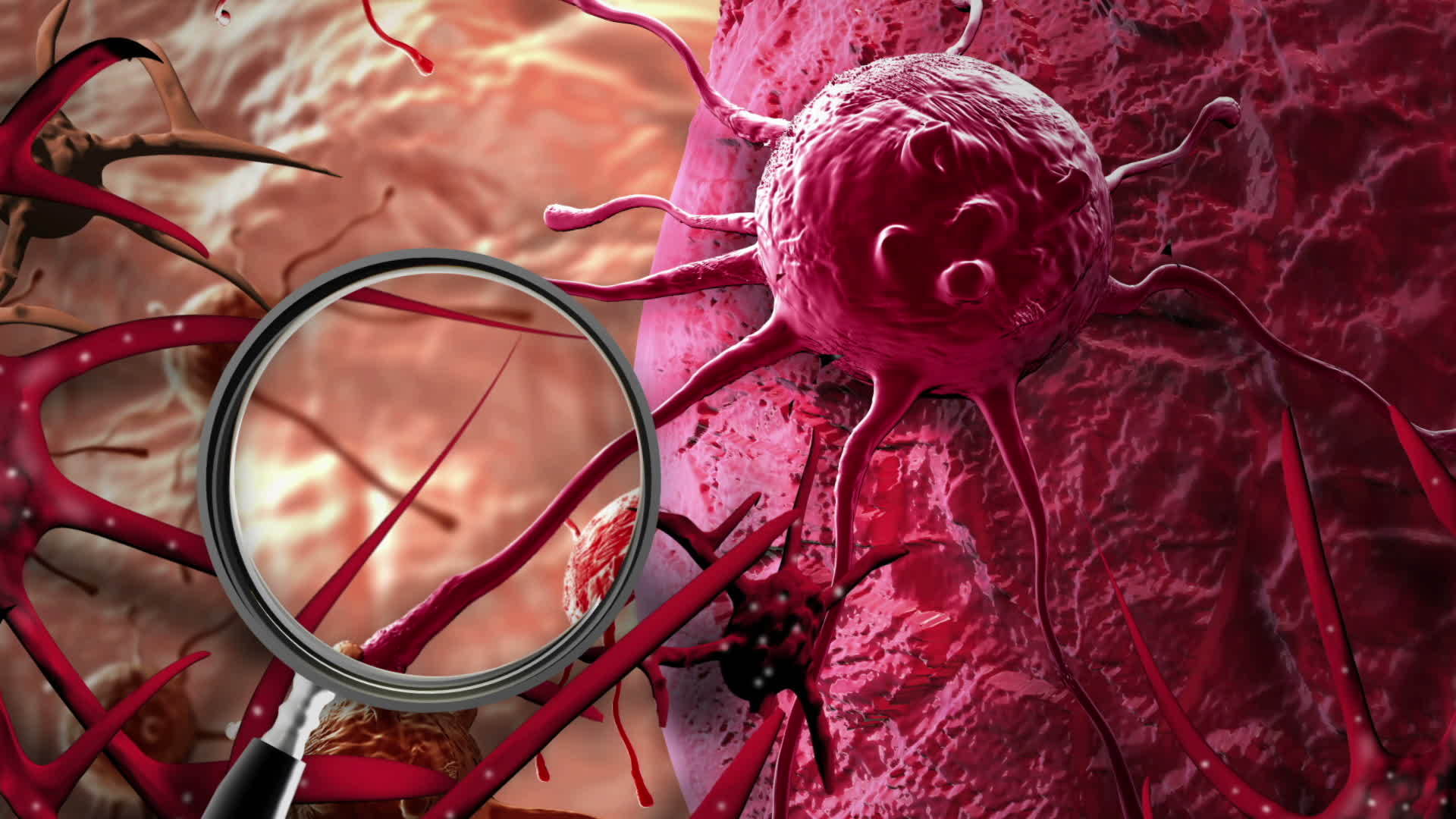 人体内癌细胞的概念视频的预览图