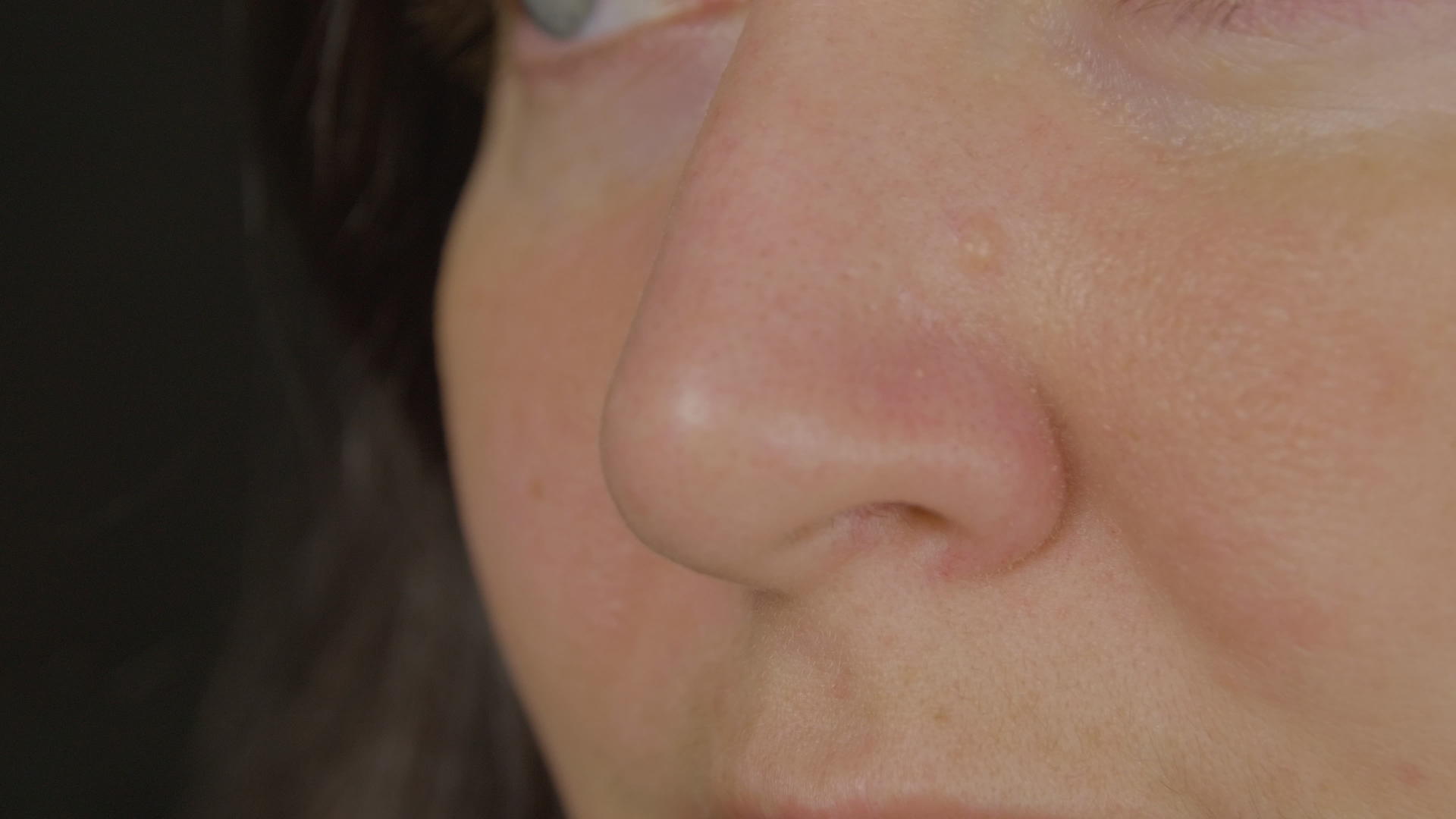 女性鼻子缝合视频的预览图