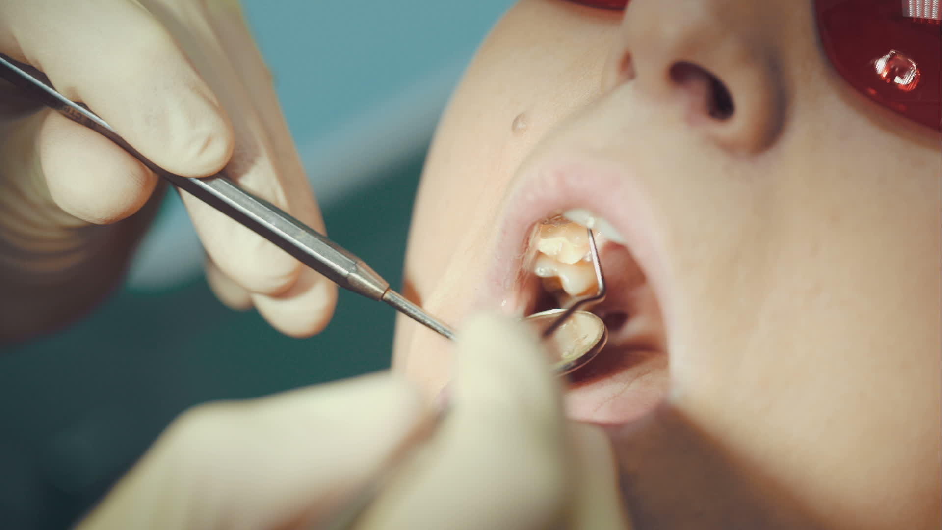 牙科牙医提供女性检查视频的预览图