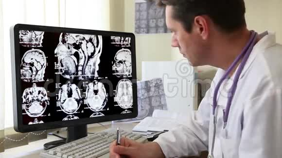 医生在看CT扫描视频的预览图
