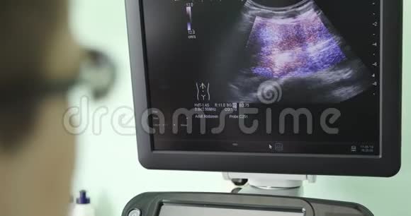 一位男医生在一家现代诊所里看超声波屏幕视频的预览图