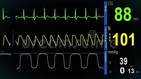 心电图心脏监视器视频的预览图