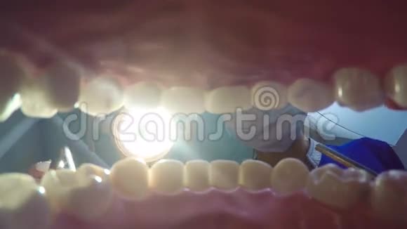 在牙医那里治疗牙齿视频的预览图