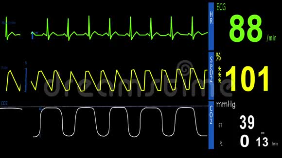 心电图心脏监护仪视频的预览图