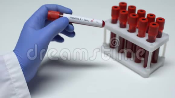 甲型肝炎检测阴性医生在试管中显示血样健康检查视频的预览图
