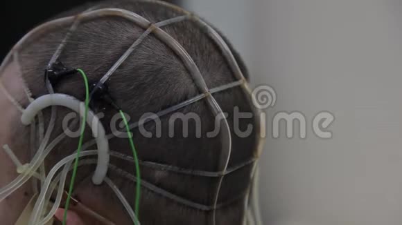 医生把电子传感器连接到病人头上进步医疗技术纳米技术视频的预览图