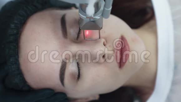 激光面部剥离手术中年轻女性的俯视图慢动作视频的预览图