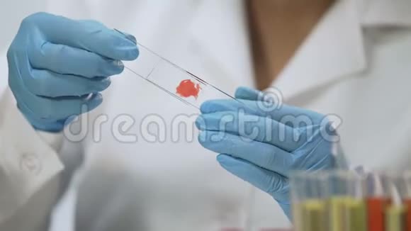 生化研究女性医学用显微镜分析血样视频的预览图