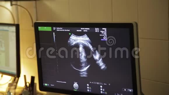 超声检查过程医生检查婴儿在快乐孕妇腹部视频的预览图