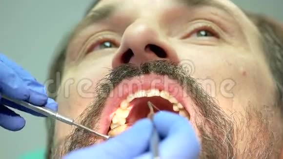 带工具的牙医手视频的预览图