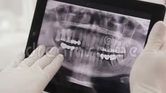 牙医显示病人X射线在平板上视频的预览图