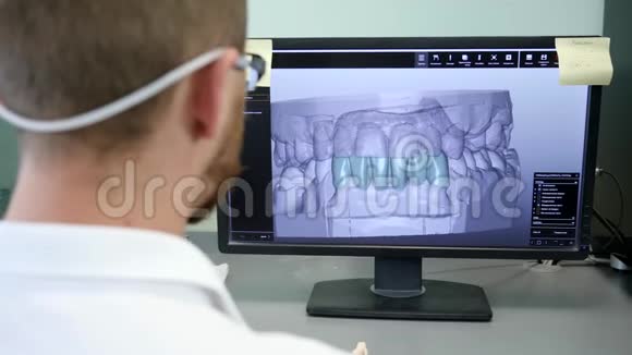 现代牙科牙齿矫正师在电脑上制作颌骨三维模型视频的预览图