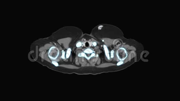 医学MRI扫描监视器CT或CAT扫描仪图像视频的预览图