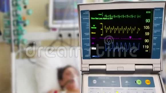 心电监护仪及主动脉内球囊反搏视频的预览图