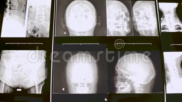 人体和大脑的MRI扫描视频的预览图