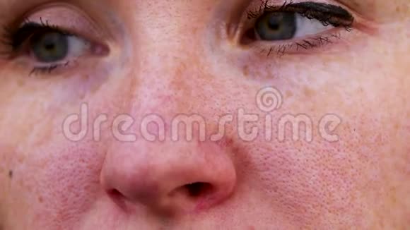 在一个年轻迷人的女孩的鼻子上毛细网格处理理念脸上的痘痘医生检查视频的预览图