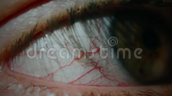 结膜炎红眼视频的预览图