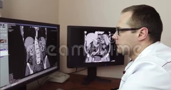 4一位疲惫的医生在坐在监视器前进行X光检查时摘下眼镜视频的预览图