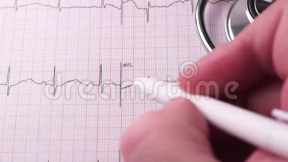 心脏的心电图视频的预览图