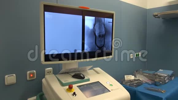 脊柱X光监视器视频的预览图