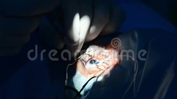 眼科门诊外科视频的预览图