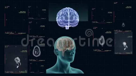 人脑不同部位的MRI表现视频的预览图