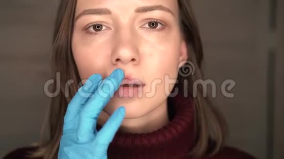 女孩嘴唇上的疱疹视频的预览图