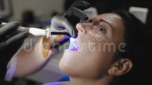 特写牙科医生的手紫外线灯针密封窥探美丽的女人视频的预览图
