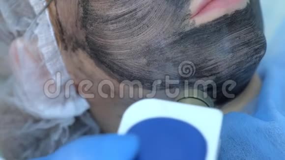 美容师对女性面部做激光碳脱皮术特写视频的预览图