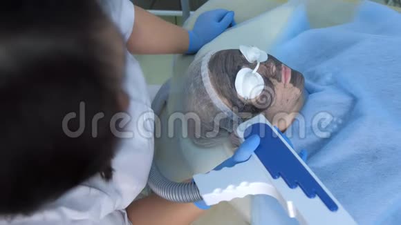 美容师对女性进行激光碳面剥离手术视频的预览图