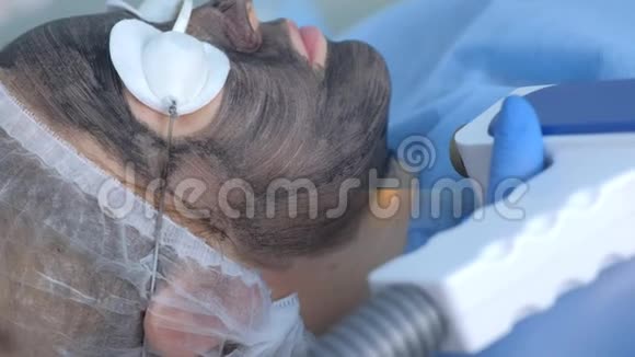 美容师对女性面部进行激光碳面剥离特写视频的预览图