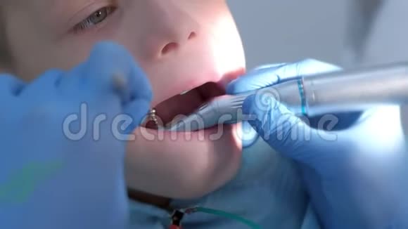 牙医卫生员在牙科为少年儿童做口腔卫生清洁视频的预览图