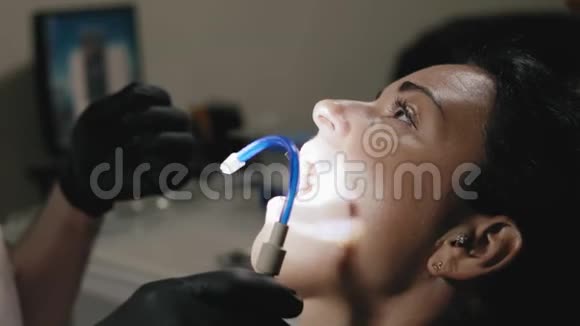 特写牙医医生洗根管牙美女视频的预览图