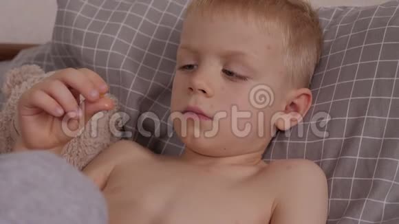 一个患有水痘的小男孩躺在床上吞咽着一颗药丸视频的预览图