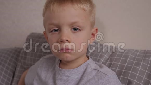 一个小男孩的特写脸上长着水痘的粉刺和水泡视频的预览图
