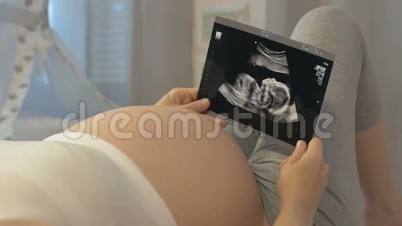 胎儿超声检查视频的预览图