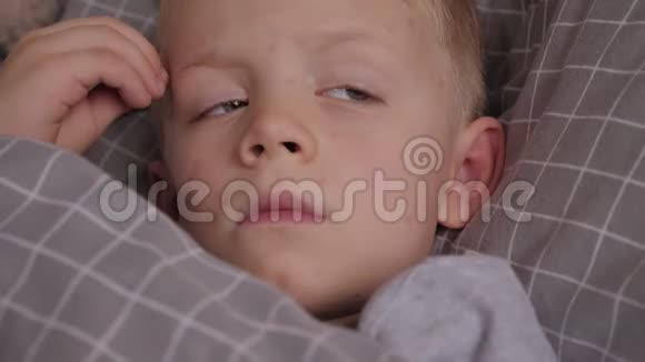 一个得了水痘的小男孩躺在床上抓他脸上的皮肤视频的预览图