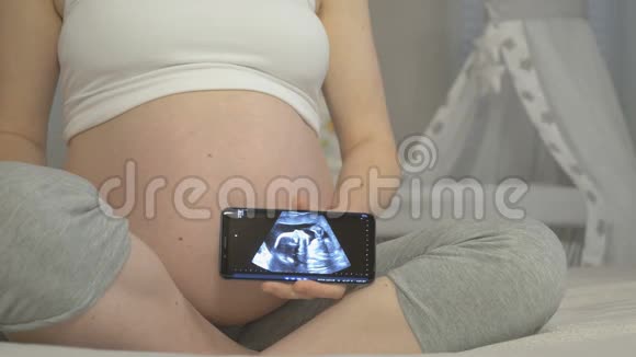 孕妇手中胎儿超声检查视频的预览图
