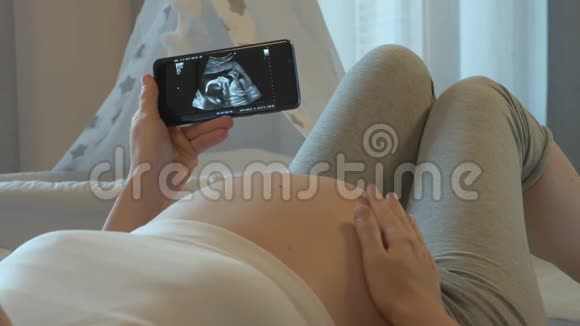 智能手机屏幕上胎儿超声检查视频的预览图