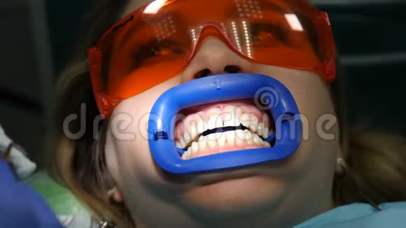 现代牙科诊所理念上景牙科诊所专业美容牙齿美白的准备女性视频的预览图