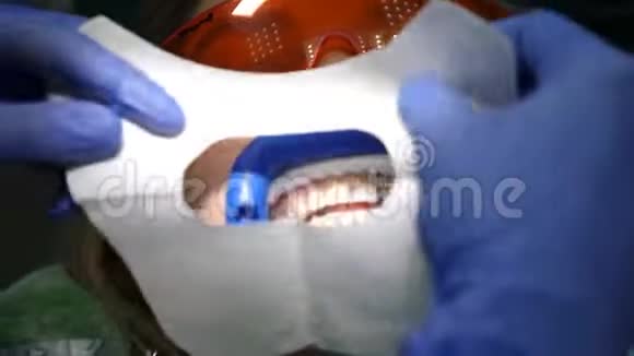 现代牙科诊所理念上景牙科诊所专业美容牙齿美白的准备女性视频的预览图