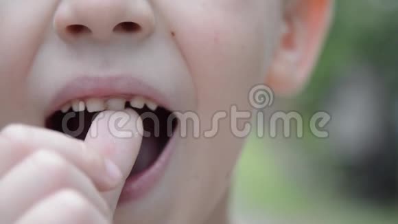 可爱的男孩用手指触摸牛奶牙齿4宝宝牙齿要掉出来了视频的预览图