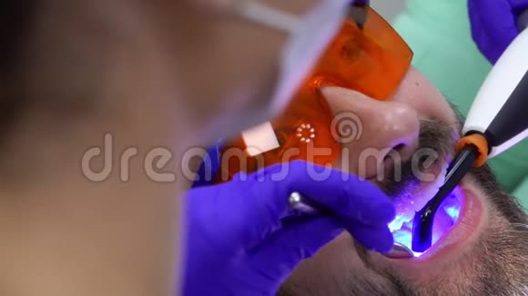 牙科医生正在用紫外线灯修补牙视频的预览图