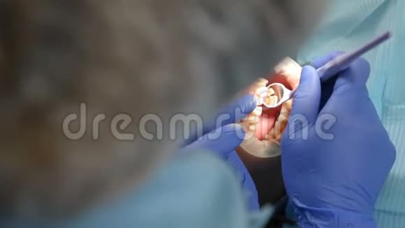 牙科行业概念在诊所工作的女牙医的特写镜头后景化妆品牙科贴面视频的预览图