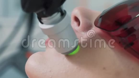 在激光脱毛过程中将女性面部的嘴唇区域闭合视频的预览图