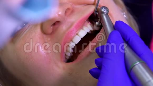 牙医正在对病人口腔进行专业的牙科清洁视频的预览图