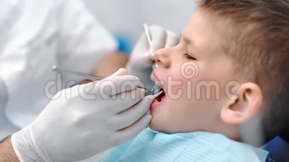 在牙科检查时用张开的嘴巴闭上男孩的脸4K红色相机拍摄视频的预览图