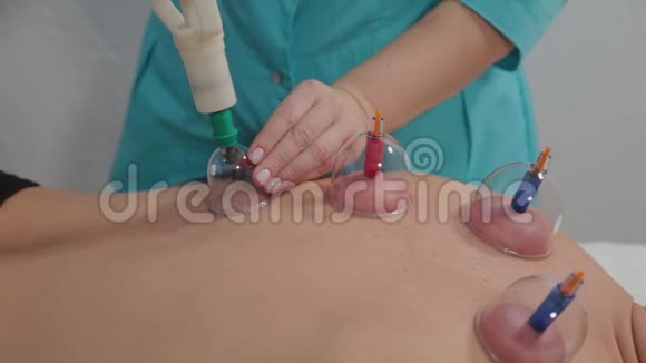 医生把真空治疗罐放在一个人的背上视频的预览图